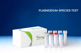 Наборы для диагностики тропических инфекций «PLASMODIUM-SPECIES-TEST», ТестГен