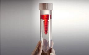 Фильтры центрифужные, 50 мл, 30 кД, белые, Jet Biofil